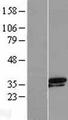 TSEN34 Protein - Western validation with an anti-DDK antibody * L: Control HEK293 lysate R: Over-expression lysate