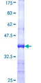 TSEN54 Protein - 12.5% SDS-PAGE Stained with Coomassie Blue.