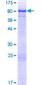 TSKS Protein - 12.5% SDS-PAGE of human TSKS stained with Coomassie Blue