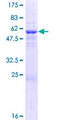 TSNAX / TRAX Protein - 12.5% SDS-PAGE of human TSNAX stained with Coomassie Blue