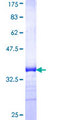 TSPAN32 / PHEMX Protein - 12.5% SDS-PAGE Stained with Coomassie Blue.
