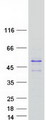 TSPY3 Protein - Purified recombinant protein TSPY3 was analyzed by SDS-PAGE gel and Coomassie Blue Staining