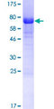 TSSC4 Protein - 12.5% SDS-PAGE of human TSSC4 stained with Coomassie Blue