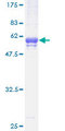 TSSK3 / STK22C Protein - 12.5% SDS-PAGE of human TSSK3 stained with Coomassie Blue
