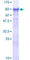 TTC30B Protein - 12.5% SDS-PAGE of human TTC30B stained with Coomassie Blue