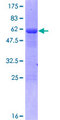 TTC33 Protein - 12.5% SDS-PAGE of human TTC33 stained with Coomassie Blue