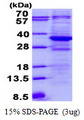 TTC33 Protein