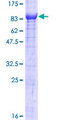 TTC39B Protein - 12.5% SDS-PAGE of human C9orf52 stained with Coomassie Blue