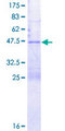 TTDN1 Protein - 12.5% SDS-PAGE of human C7orf11 stained with Coomassie Blue