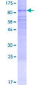 TTLL2 Protein - 12.5% SDS-PAGE of human TTLL2 stained with Coomassie Blue