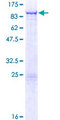 TTLL7 Protein - 12.5% SDS-PAGE of human TTLL7 stained with Coomassie Blue