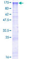 TUBGCP5 / GPC5 Protein - 12.5% SDS-PAGE of human TUBGCP5 stained with Coomassie Blue