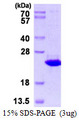 TXNDC12 Protein