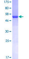 TXNDC9 Protein - 12.5% SDS-PAGE of human TXNDC9 stained with Coomassie Blue