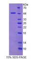 TXNIP Protein - Recombinant Thioredoxin Binding Protein 2 By SDS-PAGE