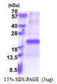 TXNRD3NB Protein