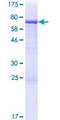 TYW2 / TRMT12 Protein - 12.5% SDS-PAGE of human TRMT12 stained with Coomassie Blue