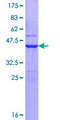 UBE2D4 Protein - 12.5% SDS-PAGE of human UBE2D4 stained with Coomassie Blue