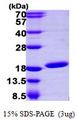 UBE2N / UBC13 Protein