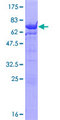 UBE2Q2 Protein - 12.5% SDS-PAGE of human UBE2Q2 stained with Coomassie Blue