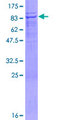 UBOX5 Protein - 12.5% SDS-PAGE of human UBOX5 stained with Coomassie Blue