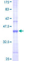 UBR1 Protein - 12.5% SDS-PAGE Stained with Coomassie Blue.