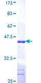 UBXD6 Protein - 12.5% SDS-PAGE Stained with Coomassie Blue.
