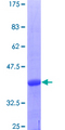 UCKL1 Protein - 12.5% SDS-PAGE Stained with Coomassie Blue.