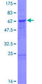 UFD1L Protein - 12.5% SDS-PAGE of human UFD1L stained with Coomassie Blue