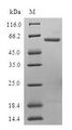 UFD1L Protein - (Tris-Glycine gel) Discontinuous SDS-PAGE (reduced) with 5% enrichment gel and 15% separation gel.