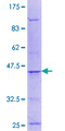 UFD1L Protein - 12.5% SDS-PAGE Stained with Coomassie Blue.