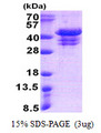 UFD1L Protein