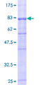 UGT1A10 Protein - 12.5% SDS-PAGE of human UGT1A10 stained with Coomassie Blue