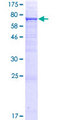 UGT2A3 Protein - 12.5% SDS-PAGE of human UGT2A3 stained with Coomassie Blue