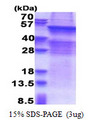 UGT8 Protein
