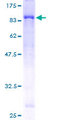 ULK4 Protein - 12.5% SDS-PAGE of human ULK4 stained with Coomassie Blue