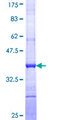 ULK4 Protein - 12.5% SDS-PAGE Stained with Coomassie Blue.