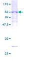 UNC5CL Protein - 12.5% SDS-PAGE of human UNC5CL stained with Coomassie Blue