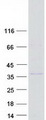 UNKL Protein - Purified recombinant protein UNKL was analyzed by SDS-PAGE gel and Coomassie Blue Staining