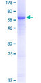 UPB1 Protein - 12.5% SDS-PAGE of human UPB1 stained with Coomassie Blue