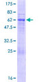 UPK3B Protein - 12.5% SDS-PAGE of human UPK3B stained with Coomassie Blue