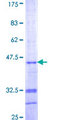 UQCRB Protein - 12.5% SDS-PAGE Stained with Coomassie Blue.