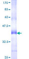 USP32 Protein - 12.5% SDS-PAGE Stained with Coomassie Blue