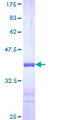USP39 Protein - 12.5% SDS-PAGE Stained with Coomassie Blue.