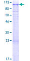 USP6NL Protein - 12.5% SDS-PAGE of human USP6NL stained with Coomassie Blue