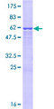 UTP15 Protein - 12.5% SDS-PAGE of human UTP15 stained with Coomassie Blue