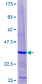 UTS2B / U2B Protein - 12.5% SDS-PAGE of human UTS2D stained with Coomassie Blue