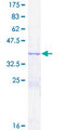 VAT1 Protein - 12.5% SDS-PAGE Stained with Coomassie Blue.