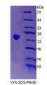 VAV3 Protein - Recombinant Vav 3 Oncogene By SDS-PAGE