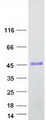 VCX Protein - Purified recombinant protein VCX was analyzed by SDS-PAGE gel and Coomassie Blue Staining